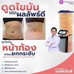 รีวิวดูดไขมันหน้าท้อง