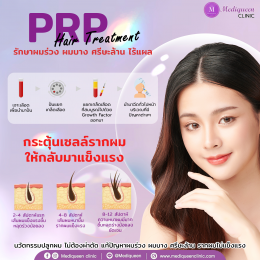 รักษาโรคข้อเสื่อมโดยการฉีดเกล็ดเลือด PRP 