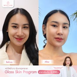 รีวิว Glass Skin