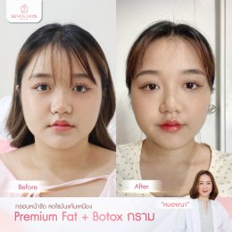 รีวิว Fat Face