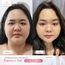 รีวิว Fat Face