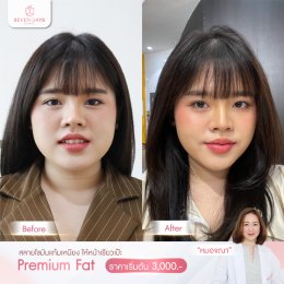 รีวิว Fat Face