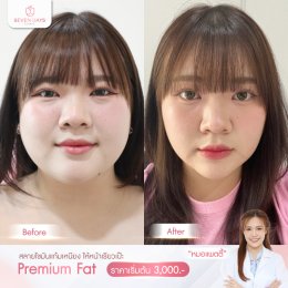 รีวิว Fat Face