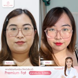 รีวิว Fat Face