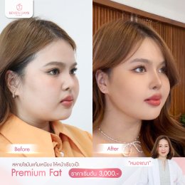 รีวิว Fat Face