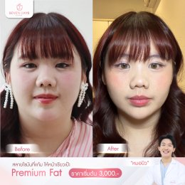 รีวิว Fat Face