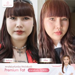 รีวิว Fat Face