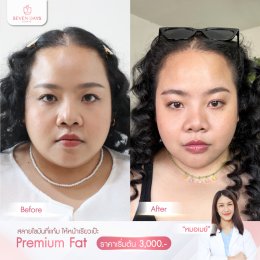 รีวิว Fat Face