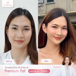 รีวิว Fat Face