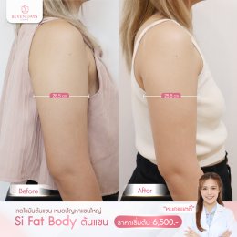 รีวิว Fat Body