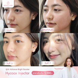 รีวิว Hycoox