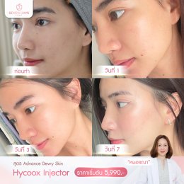 รีวิว Hycoox