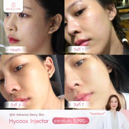 รีวิว Hycoox