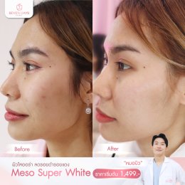 รีวิว Meso Super White