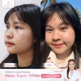 รีวิว Meso Super White