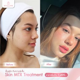 รีวิว Treatment