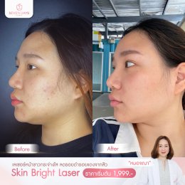 รีวิว Skin Bright