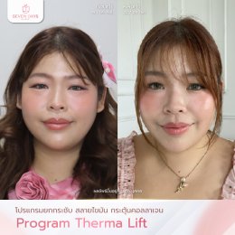 รีวิวโปรแกรม Therma Lift