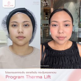 รีวิวโปรแกรม Therma Lift