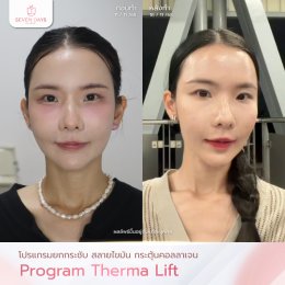 รีวิวโปรแกรม Therma Lift