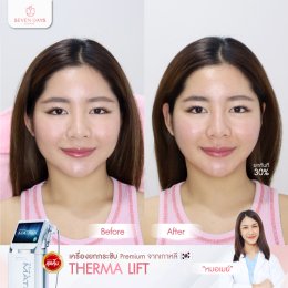 รีวิว Therma Lift