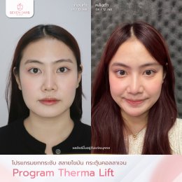 รีวิวโปรแกรม Therma Lift