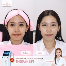 รีวิว Therma Lift