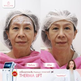 รีวิว Therma Lift