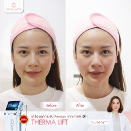 รีวิว Therma Lift