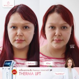 รีวิว Therma Lift