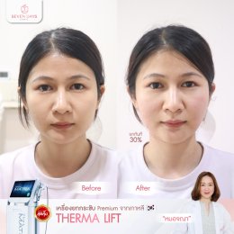 รีวิว Therma Lift