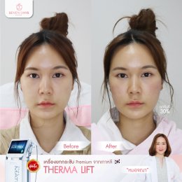 รีวิว Therma Lift