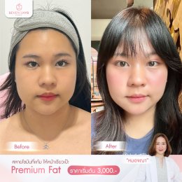 รีวิว Fat Face