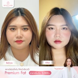 รีวิว Fat Face