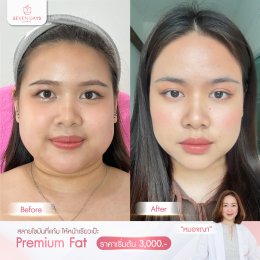 รีวิว Fat Face