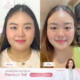 รีวิว Fat Face