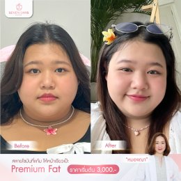 รีวิว Fat Face