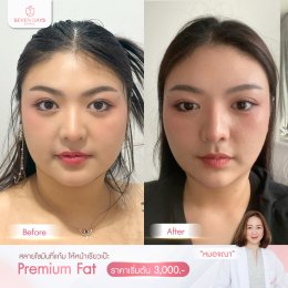 รีวิว Fat Face