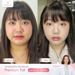 รีวิว Fat Face