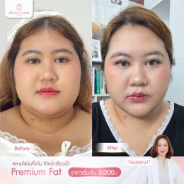 รีวิว Fat Face