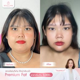 รีวิว Fat Face