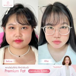 รีวิว Fat Face