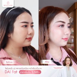 รีวิว Fat Face