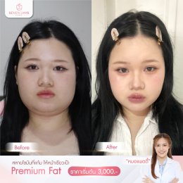 รีวิว Fat Face