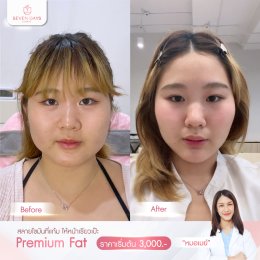 รีวิว Fat Face