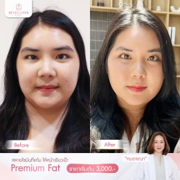 รีวิว Fat Face