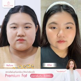 รีวิว Fat Face