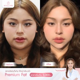 รีวิว Fat Face