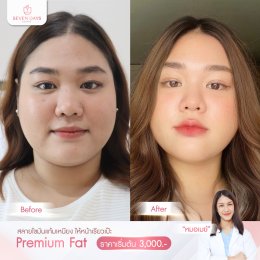 รีวิว Fat Face