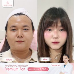 รีวิว Fat Face